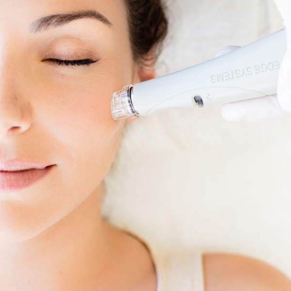Hello HydraFacial! What is HydraFacial and How Does It Work?